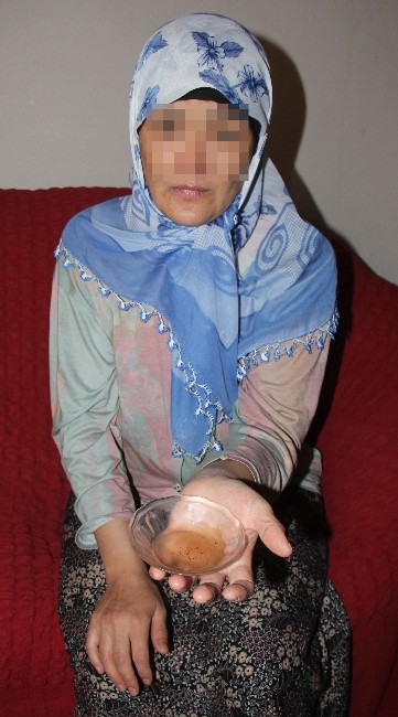 Bu kadının vücudundan sinek çıkıyor!