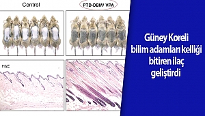 Güney Koreli bilim adamları kelliği bitiren ilaç geliştirdi  