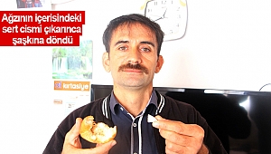  Ağzının içerisindeki sert cismi çıkarınca şaşkına döndü (videolu)