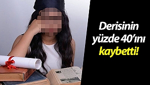 Hayati riski atlatırsa, estetik olmadan eski vücuduna kavuşabilecek