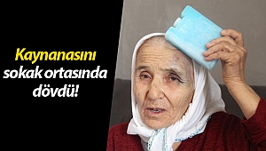 Antalya'da 80 yaşındaki kadına eski gelininden sokak ortasında dayak iddiası!