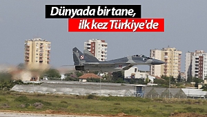 Dünyada bir tane, ilk kez Türkiye'de (Videolu)