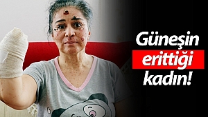 Güneşin erittiği kadın!