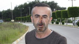 Yağmurdan kaçarken doluya tutuldular