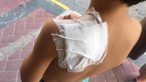Antalya'da ilkokul öğrencisi, okul dönüşü sokak kopeğinin saldırısına uğradı