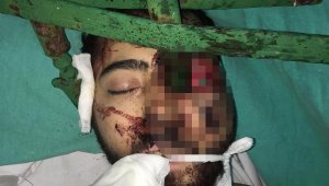 Yüzüne demir saplanan genci, itfaiye ve plastik cerrahlar kurtardı
