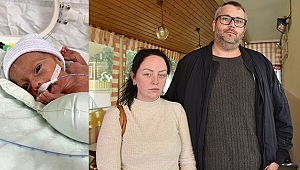 TEDAVİSİ AÜ’DE YAPILACAK