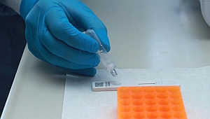 15 dakikada sonuç veren tanı kiti devrede