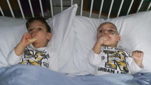 Antalyalı siyam ikizleri, İngiltere'de ayrıldı