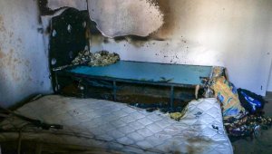 Yorgana düşürdüğü sigaradan çıkan yangında ağır yaralandı