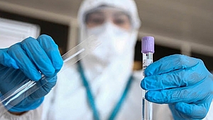 Korona testi 250 TL oldu