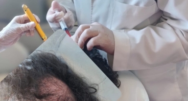 Saç dökülmesi artık sorun değil