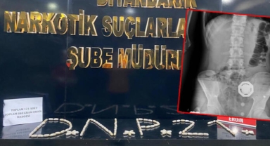 4 şüphelinin midesinden 121 parça halinde 840 gram eroin çıktı