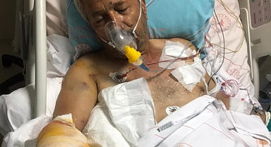 Vücudunda 300 saçma bulundu!