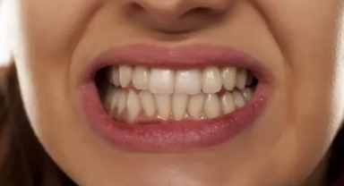 Yüzü yaşlandırıyor!