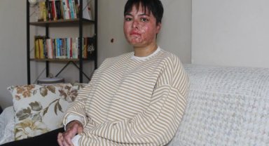 ‘Aynaya bakamıyorum’ 