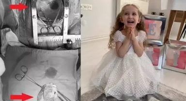 Minik kalbi 'söküldü', 'temizlendi', tekrar 'yerleştirildi'