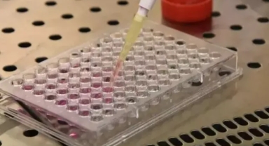 Türk profesör kanseri önleyecek çalışmasının patentini aldı