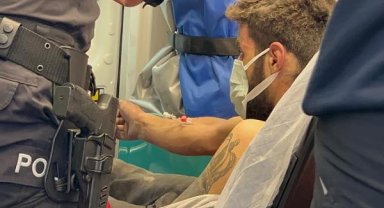 Yaktığı ateşten kolları ve boynu yandı