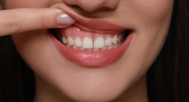 Diş eti çekilmesi (Periodontitis) nedir?