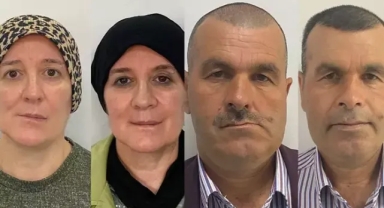 Yüzlerinin bozulmasının sebebi 'tümör' çıktı