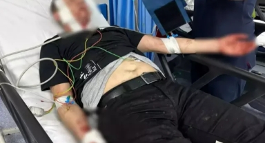 Köpeklerin saldırısına uğradı, çenesi kırıldı, elleri ve kulağı parçalandı