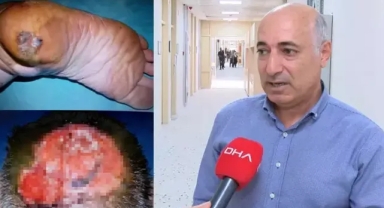 Uzmanı uyardı; O bölgedeki kanser beyne ilerleyebilir