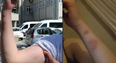 İlişki isteğini reddettiği için sevgilisini darp etti