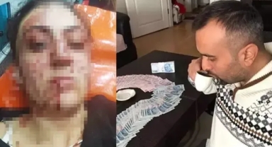 Eski eşini 7 yerinden bıçaklamıştı... 9 ayda tahliye edildi!