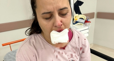 Yeğenine balyozla saldırdı