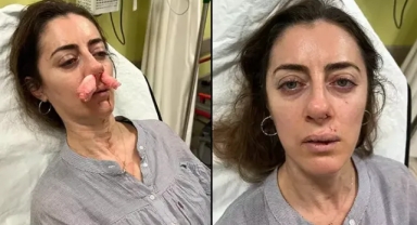 Eşinin sevgilisi sandı, darbetti