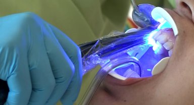 'Yanlış uygulama diş kaybına neden olabilir'