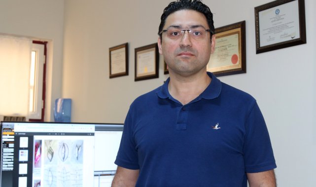 Kıl dönmesine estetik ve kalıcı müdahale