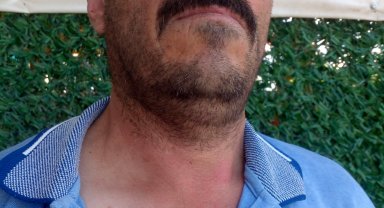 Ayının elinden dakika farkıyla kurtuldu, arı sokması sonucu hastanelik oldu