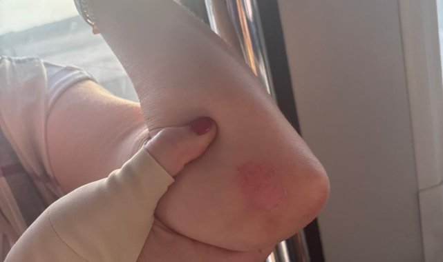 Antalya Havalimanında iniş takımından duman çıkan uçağın yolcuları slayt açılarak tahliye edildi