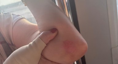 Antalya Havalimanında iniş takımından duman çıkan uçağın yolcuları slayt açılarak tahliye edildi