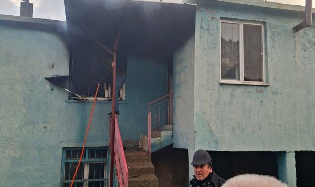 Ev yangınında yaralandı