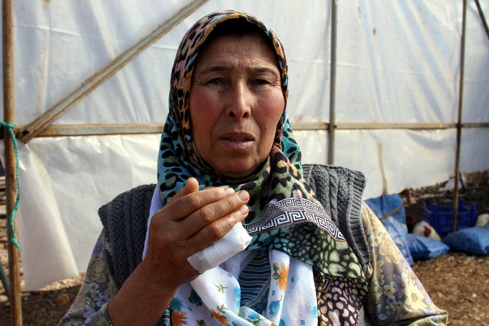 Kavgada ısırılarak kopartıldığı iddia edilen parmak mahkemeye taşınıyor