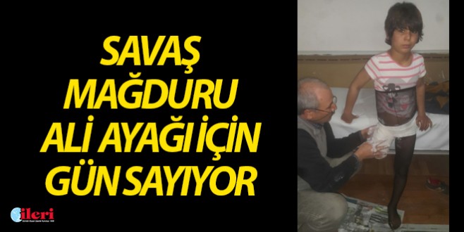 Savaş mağduru Ali ayağı için gün sayıyor