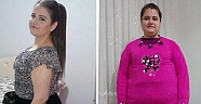 Duodenal Switch ile 5 ayda 41 kilo verdi