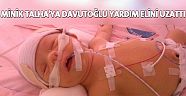 Minik Talha'ya Başbakan Davutoğlu yardım elini uzattı