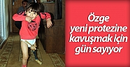 Özge yeni protezine kavuşmak için gün sayıyor