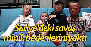 Suriye'deki savaş minik bedenlerini yaktı!