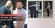 Tüp mide yöntemiyle 48 kilo verdi
